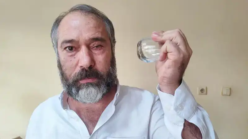 Çaycıdan Küfür Yiyen Müşteri Gözünü Kaybetti! İşte O Korkunç Olay