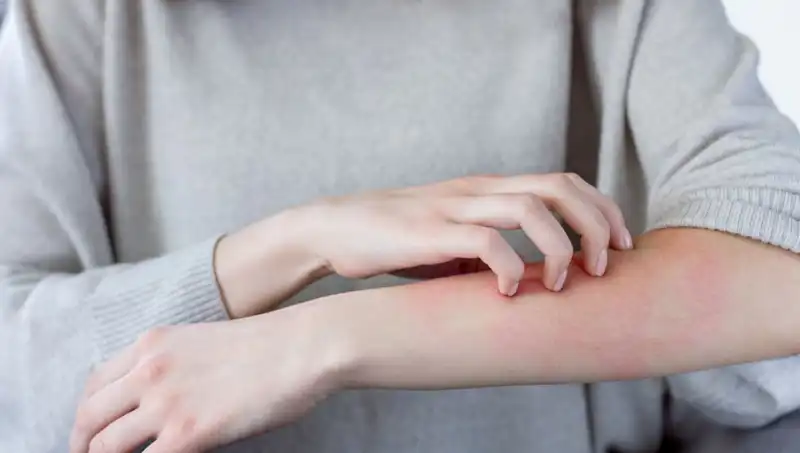 Cilt Kanserinin Gözden Kaçan İki Belirtisi: Dermatologdan Kritik Uyarılar