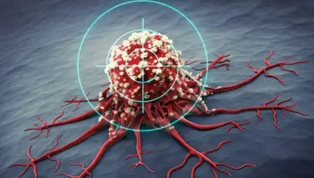 Prostat Kanserine Karşı Etkili 6 Besin: Bilim Dünyası Onayladı