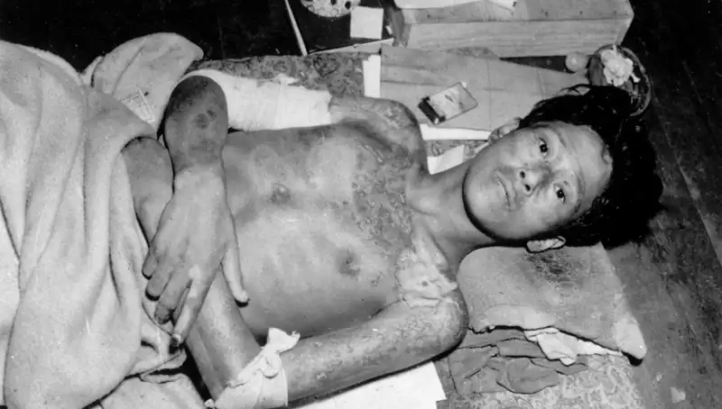 80 Yıl Sonra Nagasaki’nin Korkutan Çağrısı: Nükleer Tehdit Kapıda