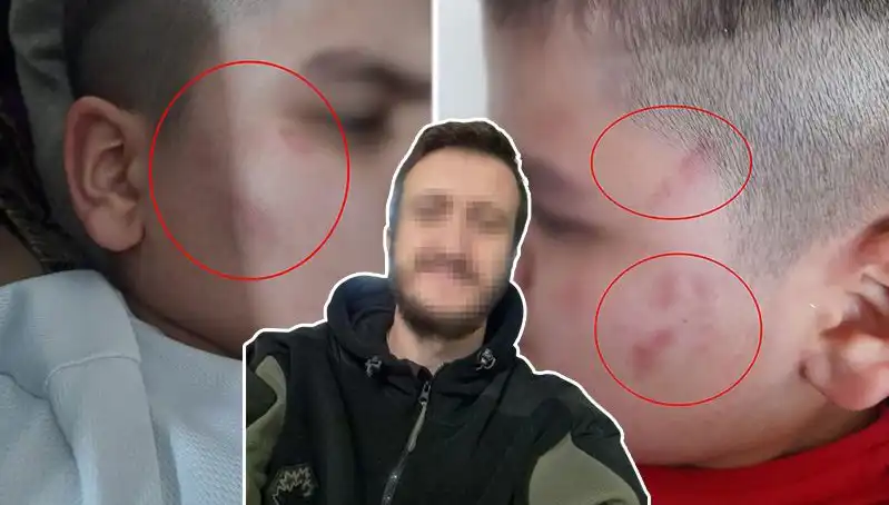 Otizmli Çocuğa Okulda Dayak İddiası: Veliler ve Uzmanlar Tepki Gösterdi