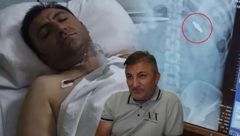 15 Temmuz'un Karanlık Mirası: Kurşunla Yaralananların Hikayesi