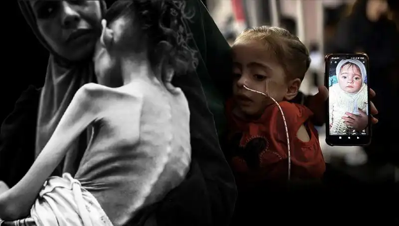 Küçük Meryem'in Zorlu Mücadelesi: 25 Kilodan 10 Kiloya Düşüşü