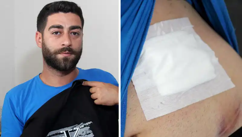 Karnındaki Ağrının Sırrı: Röntgen Sonucu Şok Etti!